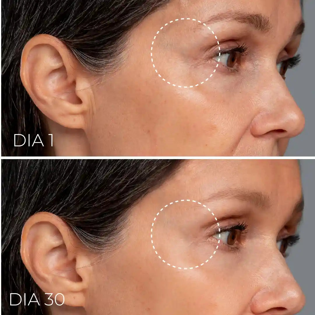 SERUM ACIDO HIALURONICO