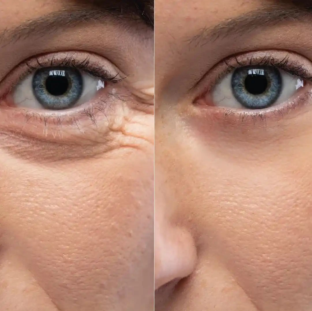Crema contorno de ojos